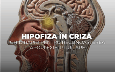 Hipofiza în criză – ghid rapid pentru recunoașterea apoplexiei pituitare