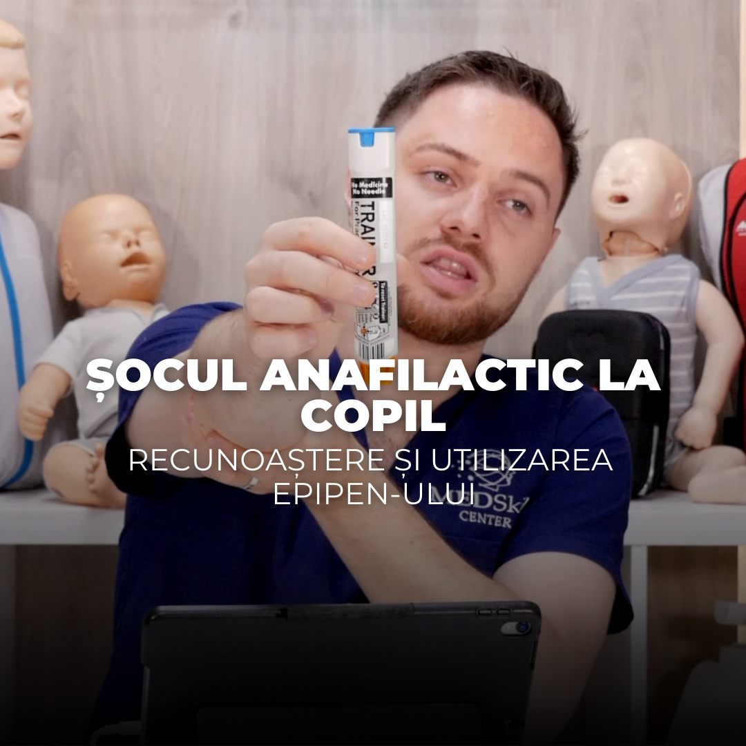 Șocul anafilactic la copil