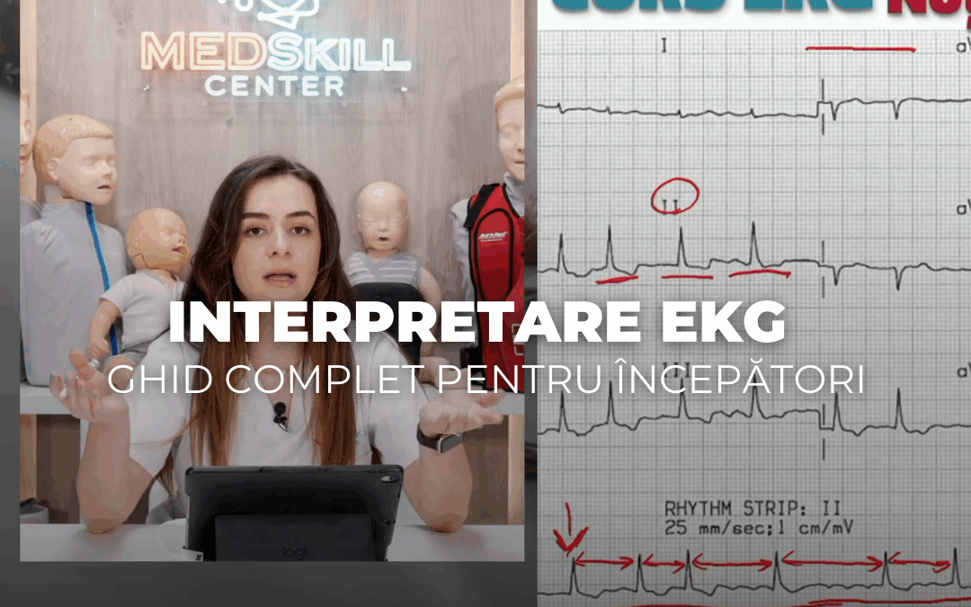 Interpretare EKG – ghid complet pentru începători