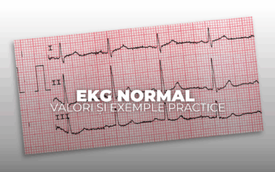 EKG normal – valori și exemple practice