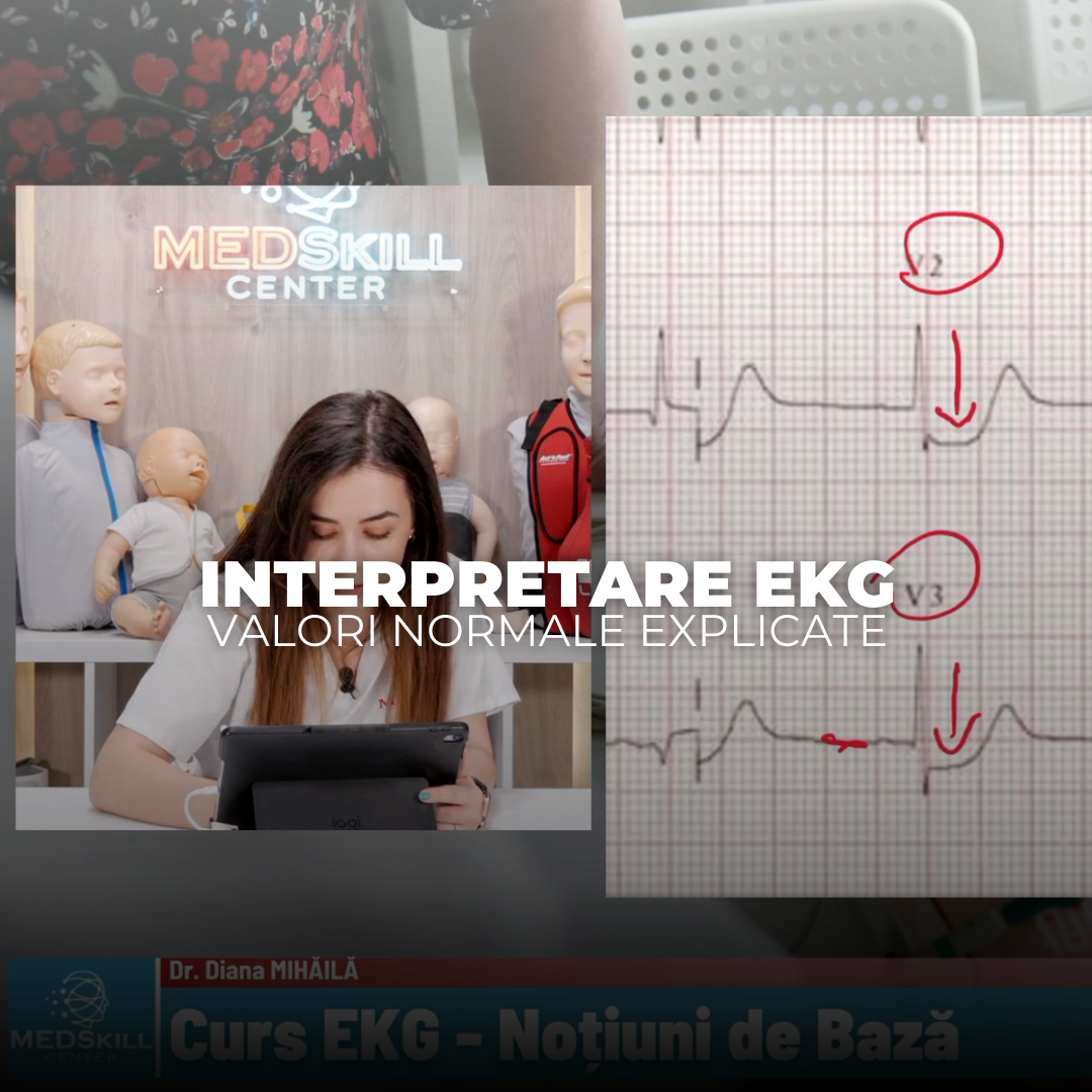 Interpretare EKG