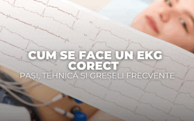Cum se face un EKG corect – pași, tehnică și greșeli frecvente
