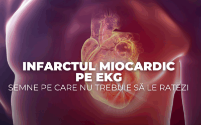 Infarctul miocardic pe EKG – semne pe care nu trebuie să le ratezi