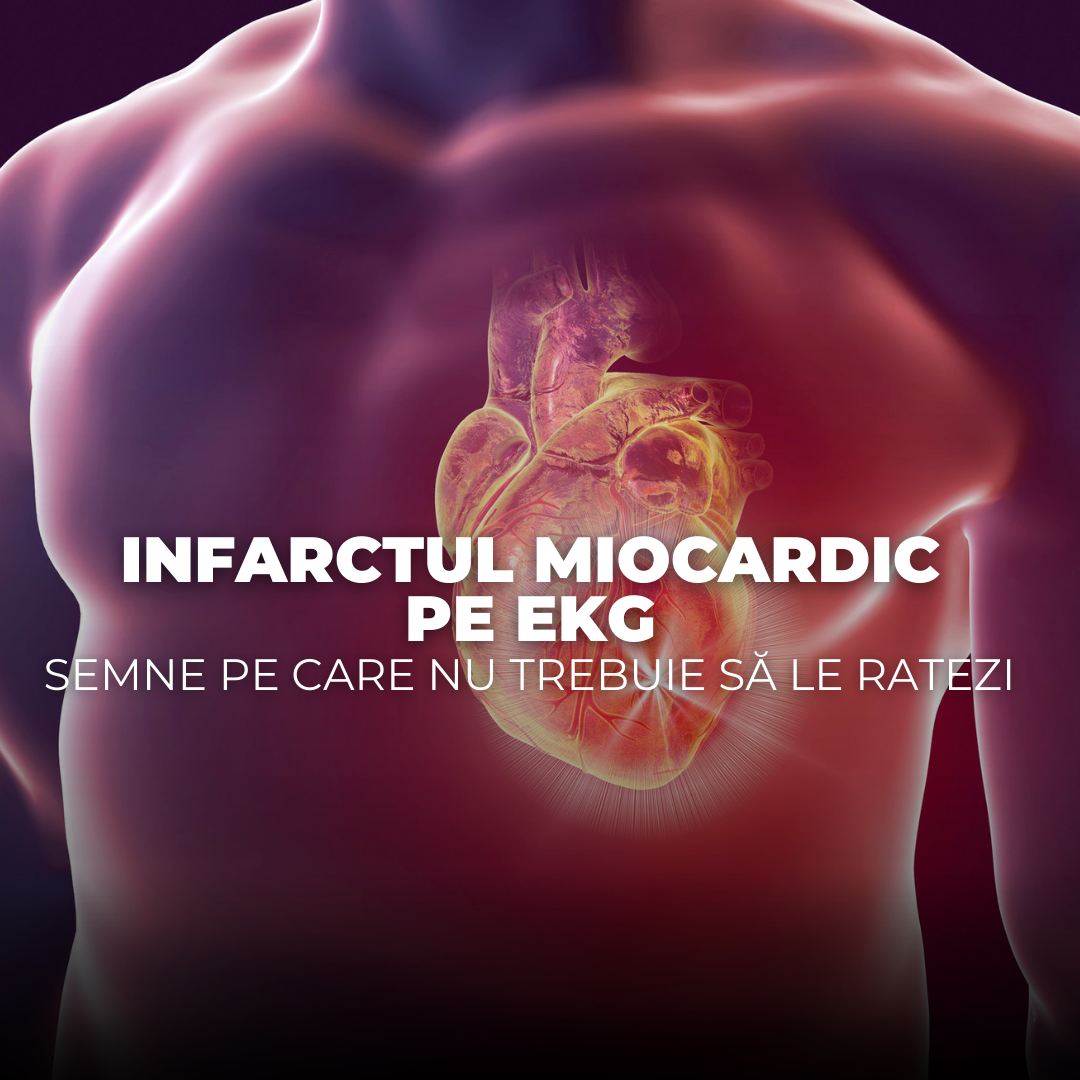 Infarctul miocardic pe EKG