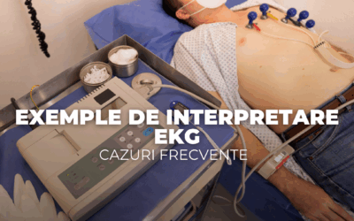 Exemple de interpretare EKG – cazuri frecvente