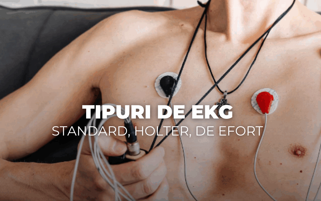 Tipuri de EKG – standard, Holter, de efort