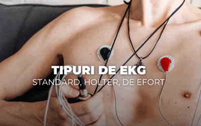 Tipuri de EKG – standard, Holter, de efort