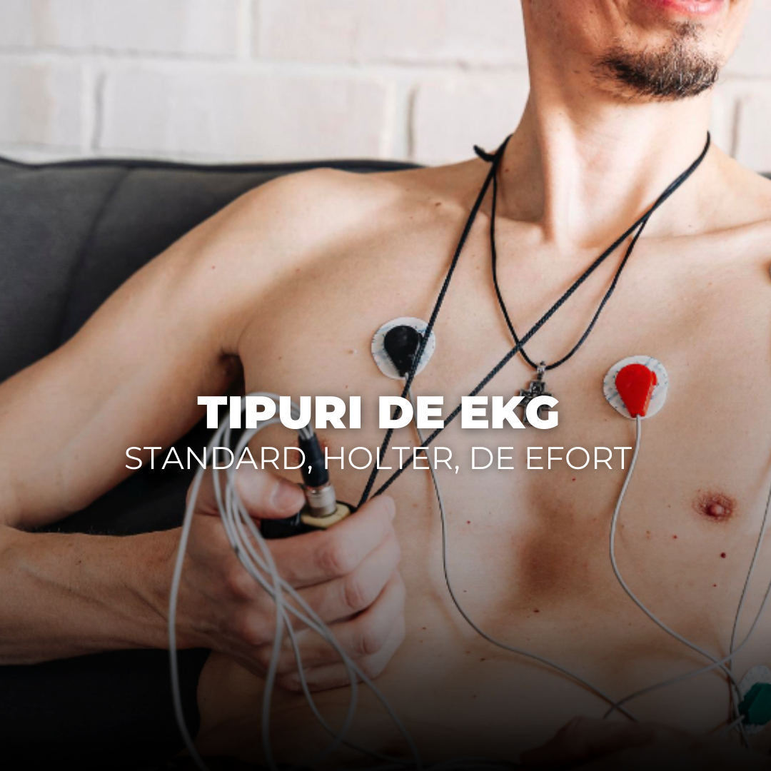 Tipuri de EKG – standard, Holter, de efort