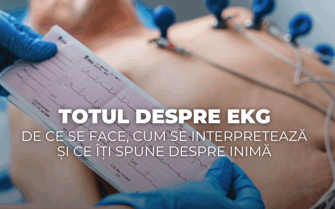 Totul despre EKG – de ce se face, cum se interpretează și ce îți spune despre inimă