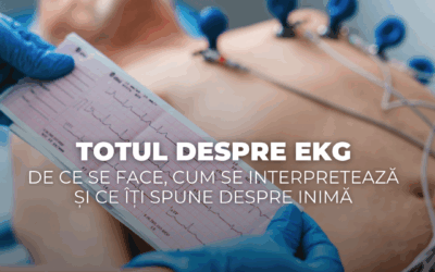 Totul despre EKG – de ce se face, cum se interpretează și ce îți spune despre inimă