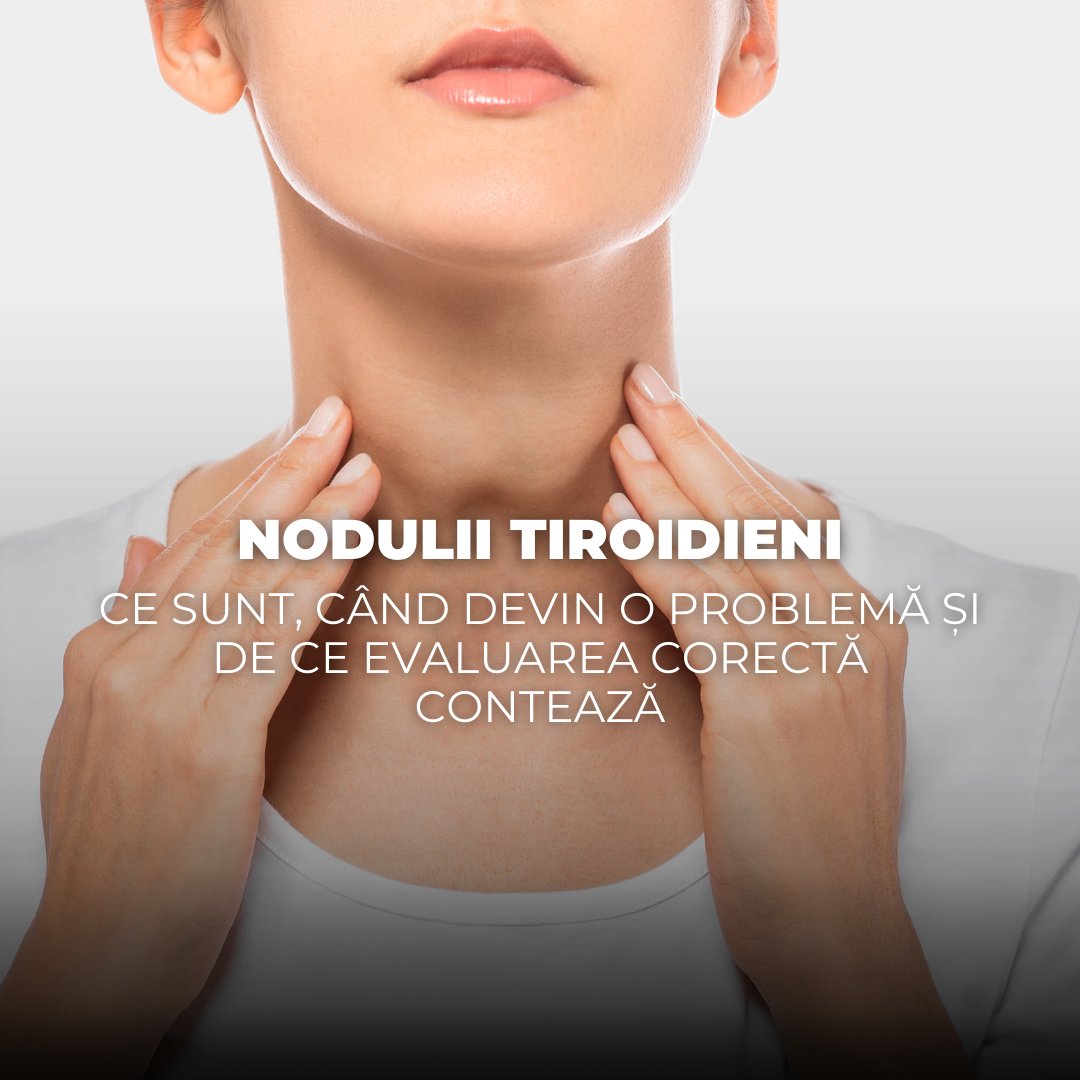 Nodulii tiroidieni