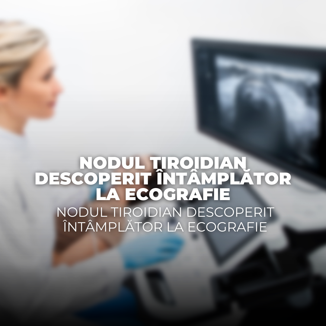 Nodul tiroidian descoperit întâmplător la ecografie