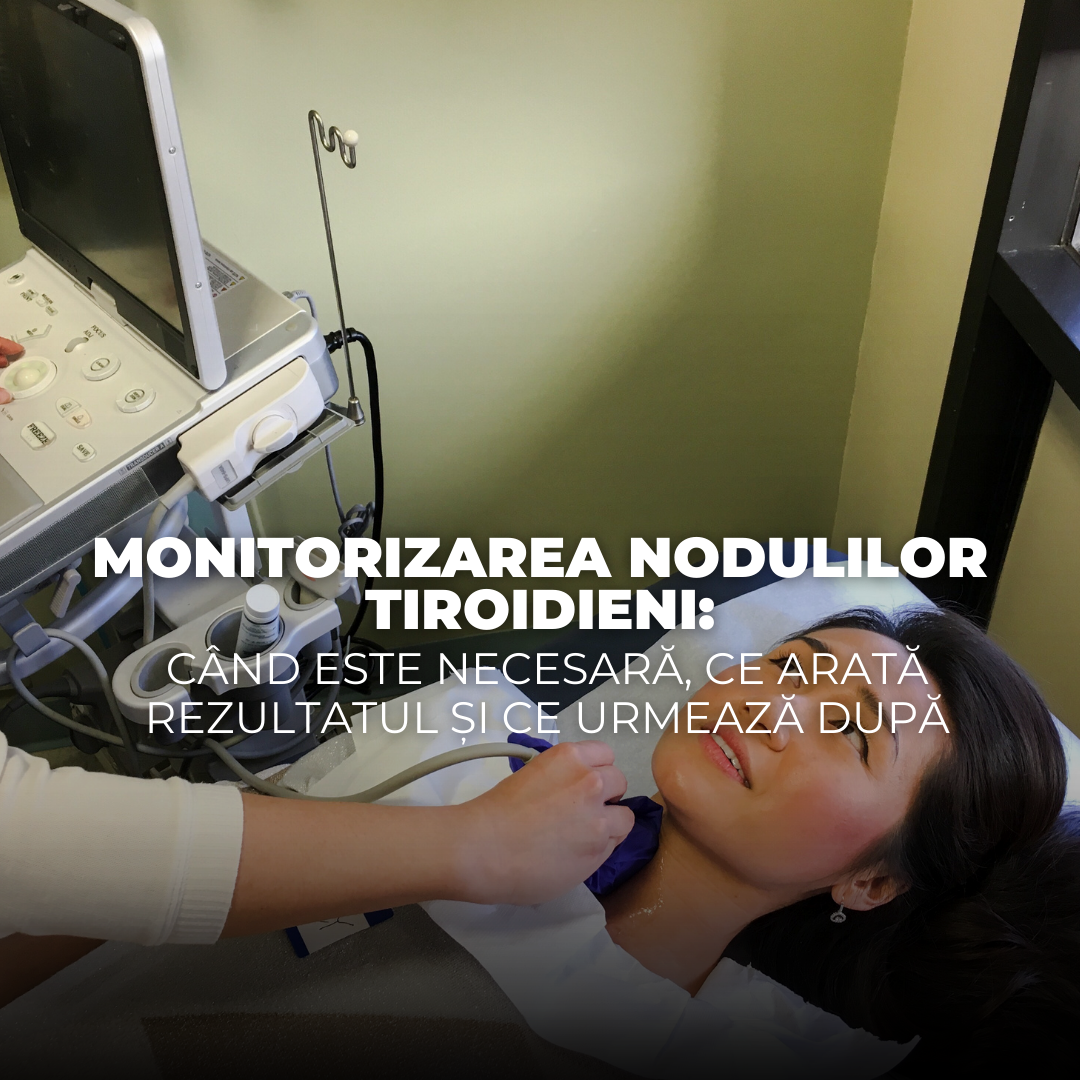 monitorizarea nodulilor tiroidieni
