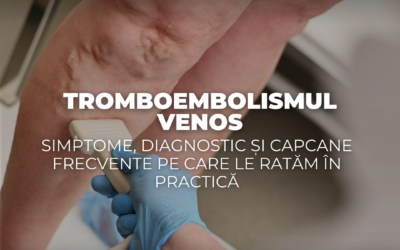 Tromboembolismul venos: simptome, diagnostic și capcane frecvente pe care le ratăm în practică